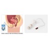 Globus Sonda Vaginale G6725  Accessorio per Elettrostimolazione del Pavimento Pelvico